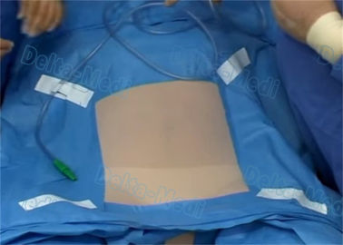 外科LaparoscopyはETOの青色と、生殖不能の使い捨て可能な患者おおいますおおいます