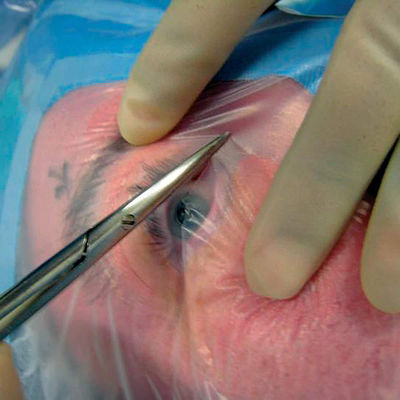 Formableの眼の形成するものの使い捨て可能な生殖不能の外科はケーブルのホールダーとおおう